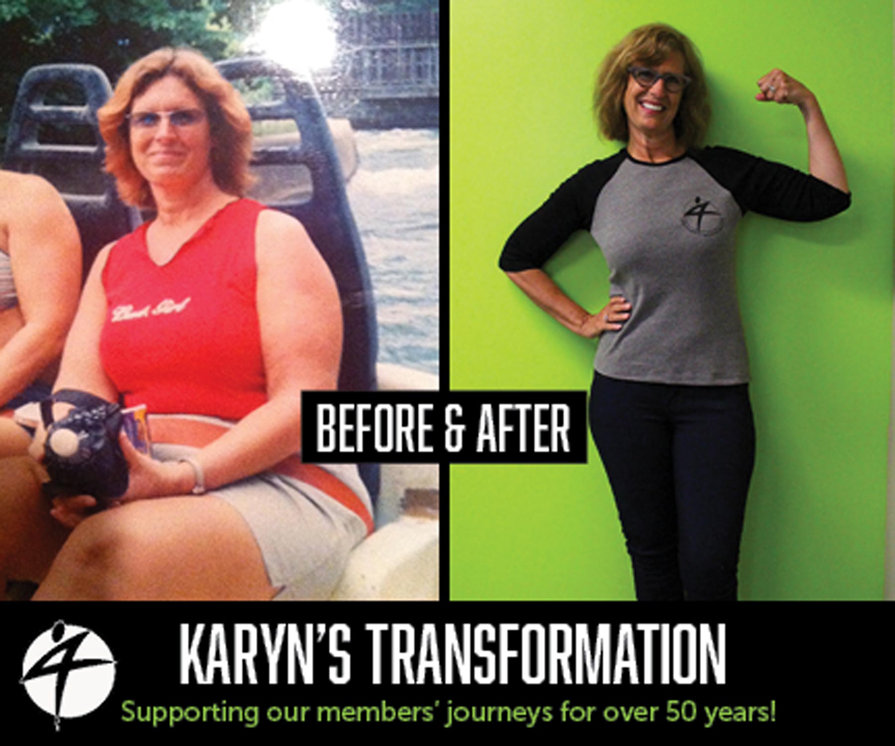 Karyn-Spelde_Before-and-After-Aug-2017