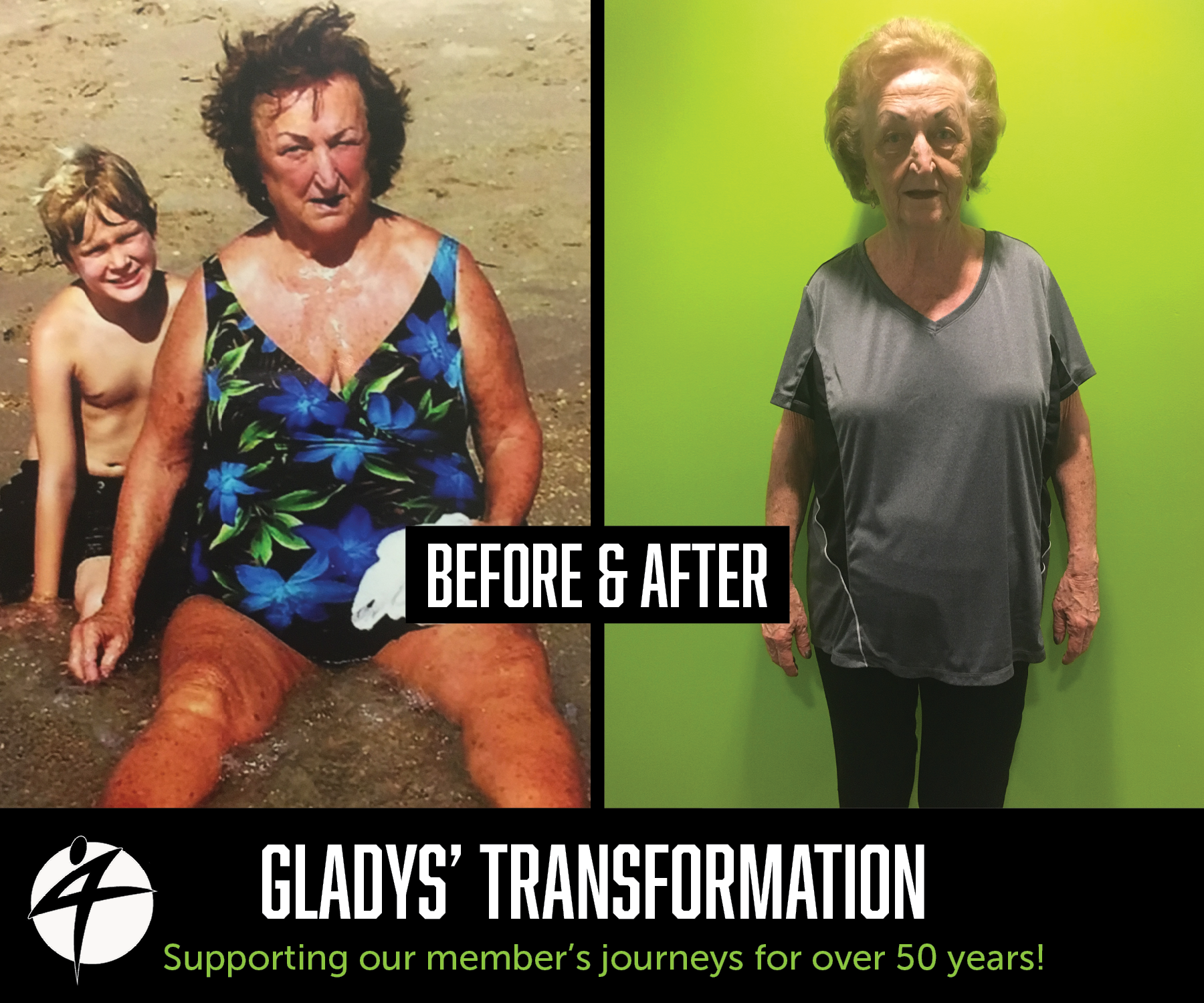 Gladys Before and After May 2018